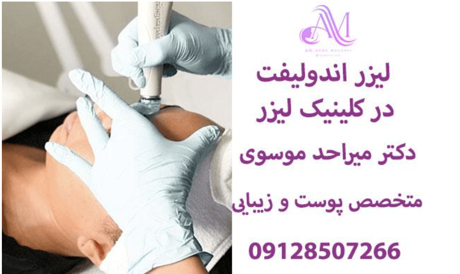 بهترین لیزر های جوانساز پوست که خیلی مد شدن