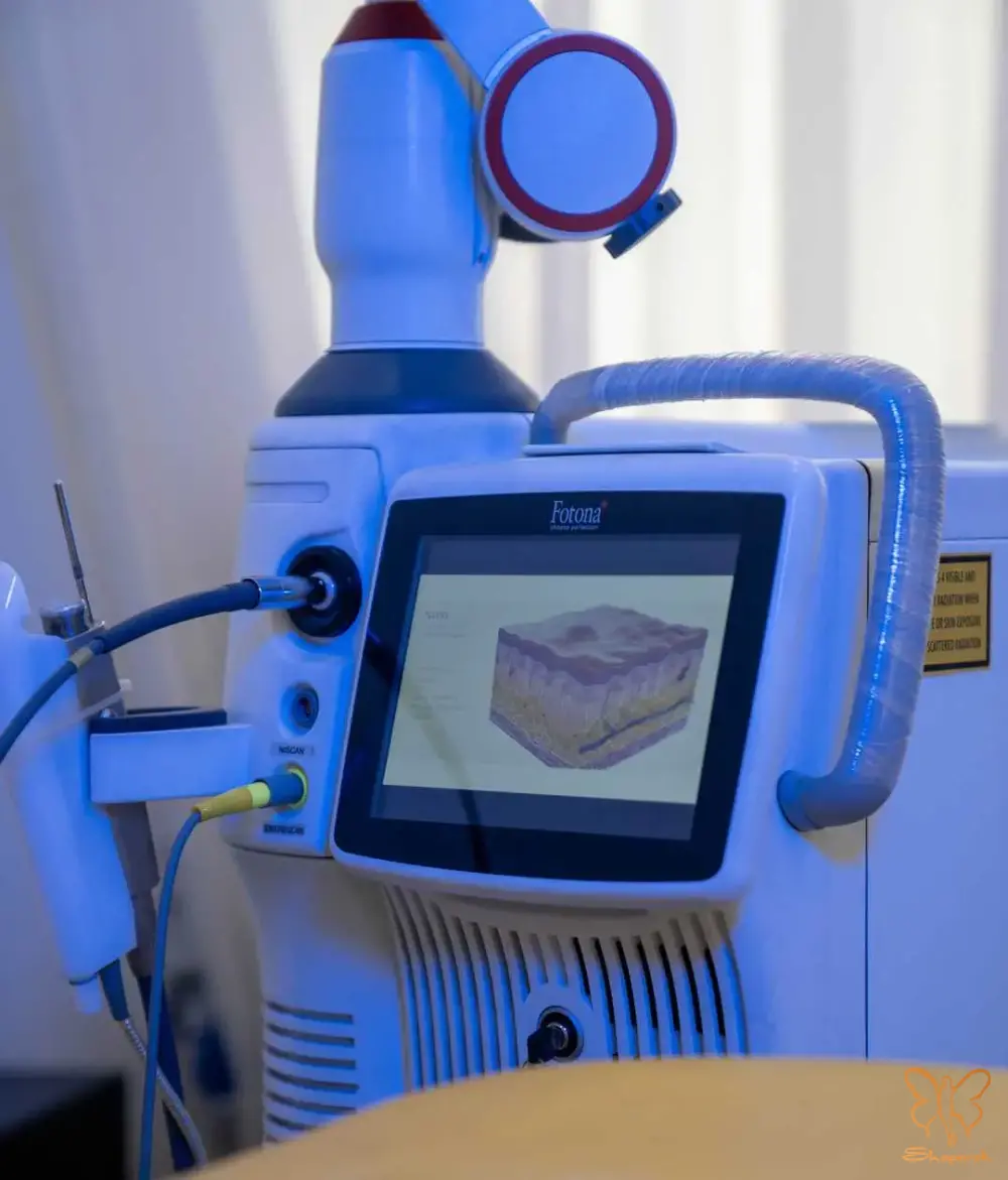 درمان ترک پوستی با لیزر فوتونا