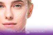 لیزر اندولیفت - جدیدترین تکنیک جوانسازی دائمی پوست