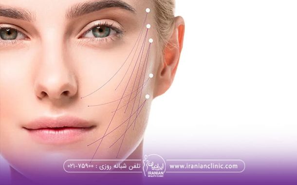 لیزر اندولیفت - جدیدترین تکنیک جوانسازی دائمی پوست
