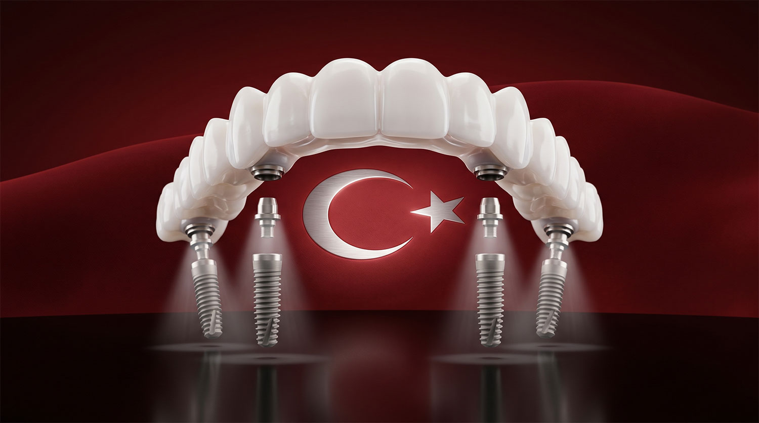 turkey-overdenture-price