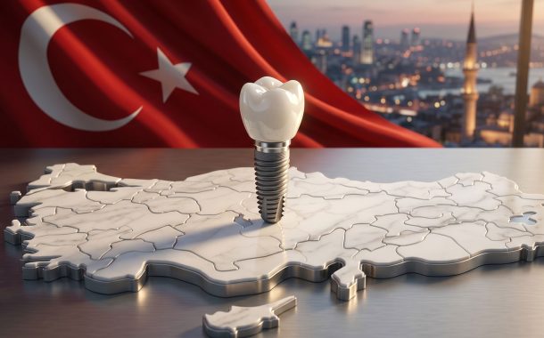 هزینه ایمپلنت دندان در ترکیه 1405 | قیمت، مزایا، معایب و مقایسه با ایران