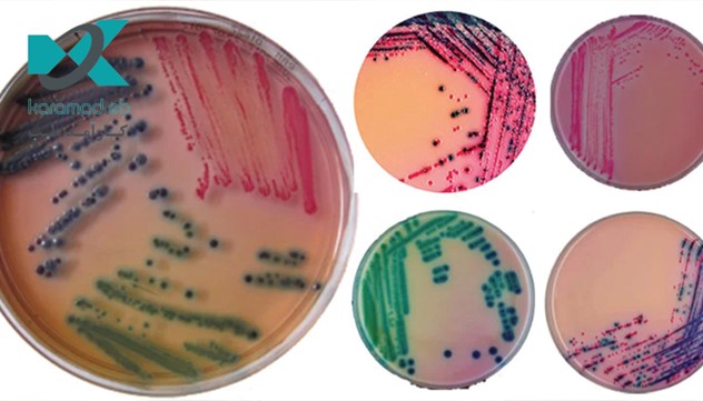 محیط کشت کروم آگار و مزایای آن