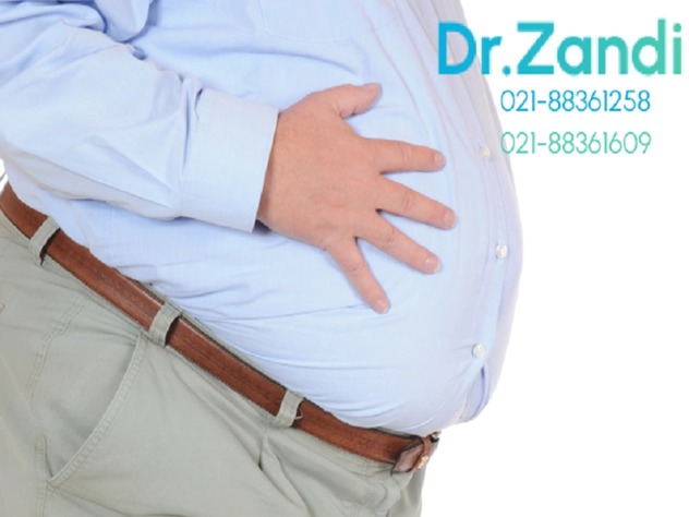 تاثیر عمل چاقی بر درمان دیابت نوع 2 