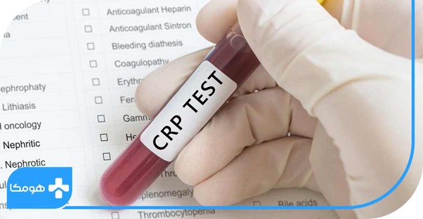 آیا اختلالات خود ایمنی قابل تشخیص هستند؟