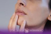 قیمت اندولیفت در تهران چقدر است؟