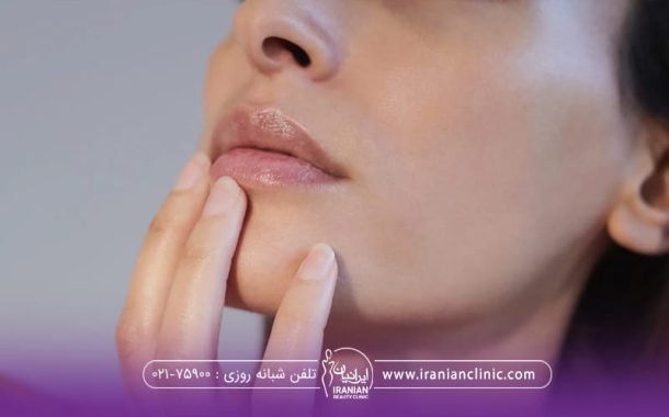 قیمت اندولیفت در تهران چقدر است؟