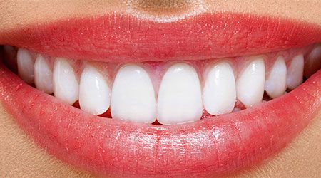 نکاتی از مبلمان روف گاردن که در اجرای روف گاردن باید به آنها توجه داشت