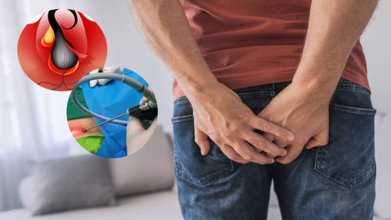 کپسول اکسیژن و مانومتر از کجا بخریم و نحوه استفاده از کپسول اکسیژن چگونه است؟