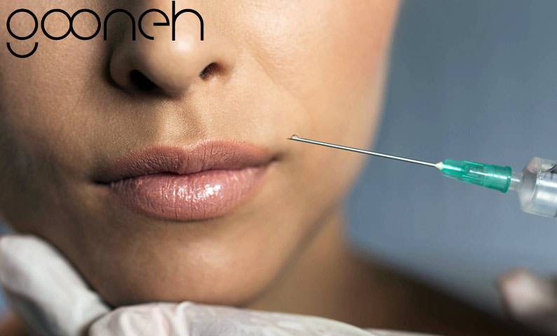 راهکارهای جدید برای زیبایی چشم با کاشت ابرو، لیفت پلک و لیفت با نخ