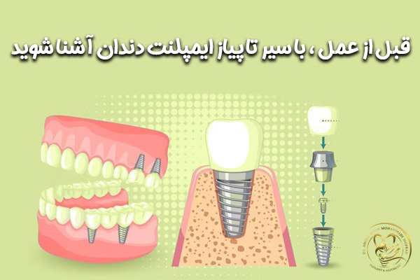 کشف دیدنی های ناشناخته ارومیه: از دریاچه تا کوه ها