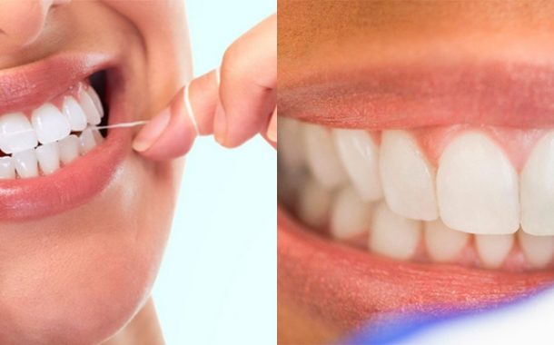 مراقبت از لمینت های سرامیکی