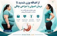 از اضافه وزن شدید تا درمان اصولی با جراحی چاقی