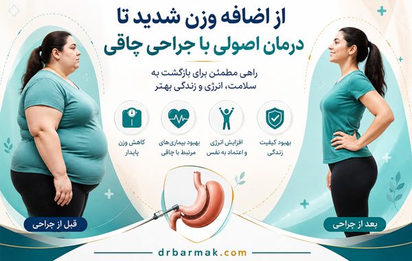 از اضافه وزن شدید تا درمان اصولی با جراحی چاقی