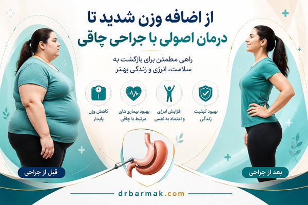 از اضافه وزن شدید تا درمان اصولی با جراحی چاقی